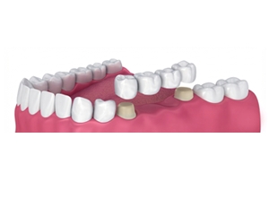 Routine Dental Checkup