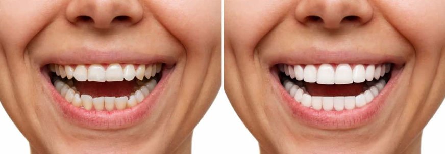 Premier Dentist in Abu Dhabi