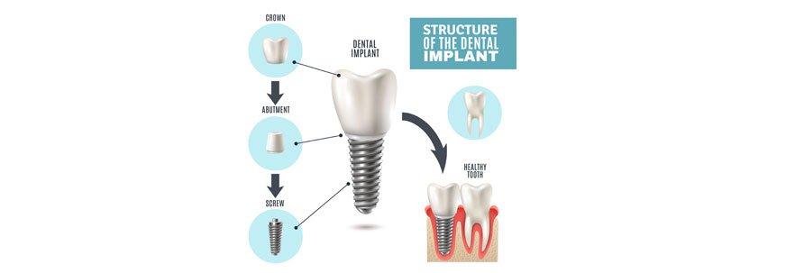 Premier Dentist in Abu Dhabi