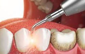 Trusted Dental Clinic