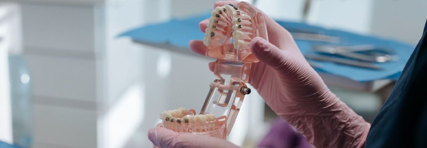 Advanced Orthodontic Treatments in Abu Dhabi