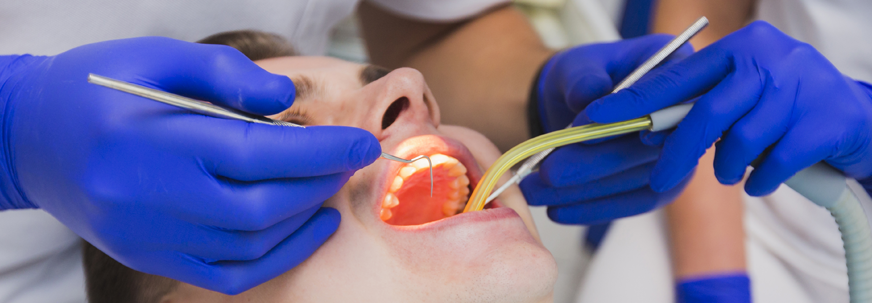 Tooth Extraction